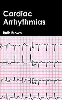 Cardiac Arrhythmias (Hardcover)