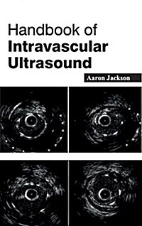 Handbook of Intravascular Ultrasound (Hardcover)