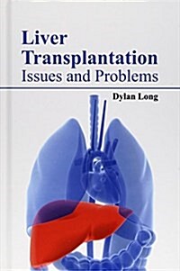 Liver Transplantation: Issues and Problems (Hardcover)