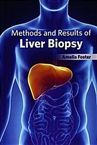 Methods and Results of Liver Biopsy (Hardcover)