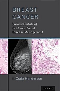 Breast Cancer: Fundamentals of Evidence-Based Disease Management (Paperback)