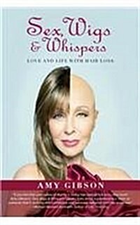 Sex, Wigs & Whispers: Love and Life with Hair Loss (Paperback)