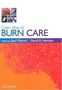 Color Atlas of Burn Care, 1e (Hardcover)