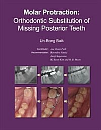 Molar Protraction:: Orthodontic Substitution of Missing Posterior Teeth (Paperback)