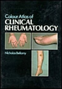 Colour Atlas of Clinical Rheumatology (Hardcover, 1)