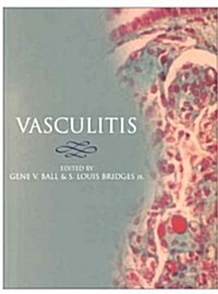 Vasculitis (Hardcover, 1)