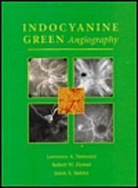 Indocyanine Green Angiography, 1e (Hardcover)
