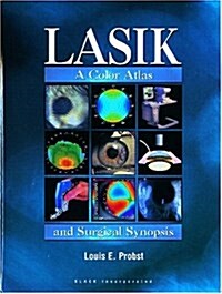 LASIK: A Color Atlas and Surgical Synopsis (Hardcover)