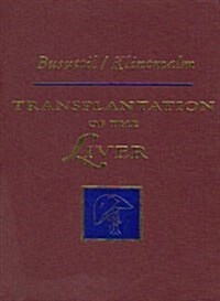 Transplantation of the Liver, 1e (Hardcover, 1st)