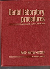 Dental Laboratory Procedures. Removable Partial Dentures, Volume 3 (Hardcover, 2 Sub)