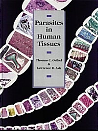 Parasites in Human Tissues (Hardcover, 1)