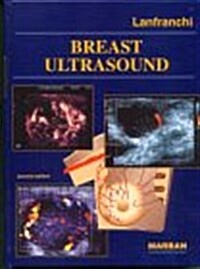 Breast Ultrasound (Hardcover, 2nd)
