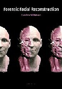 Forensic Facial Reconstruction (Hardcover)