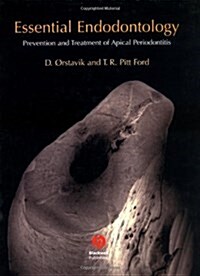 Essential Endodontology: Prevention and Treatment of Apical Periodontitis (Hardcover, 1)