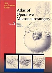 Atlas of Operative Microneurosurgery, Vol. 2: Brain Tumors (Hardcover)