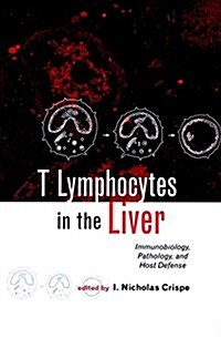 T Lymphocytes in the Liver: Immunobiology, Pathology, and Host Defense (Hardcover, 1)