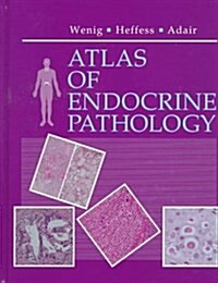 Atlas of Endocrine Pathology: A Volume in the Atlases in Diagnostic Surgical Pathology Series, 1e (Hardcover, 1st)