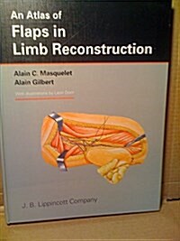 Atlas of Flaps in Limb Reconstruction (Hardcover, 0)