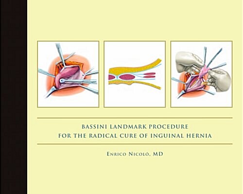 Bassini Landmark Procedure for the Radical Cure of Inguinal Hernia (Hardcover)