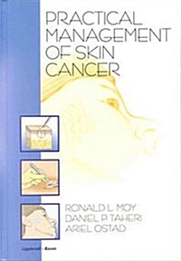 Practical Management of Skin Cancer (Hardcover)