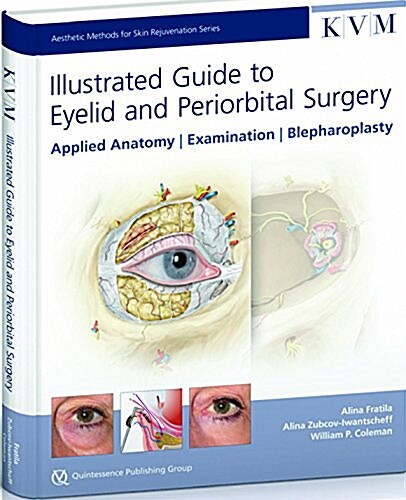 Illustrated Guide to Eyelid & Periorbital Surgery (Hardcover, Illustrated)