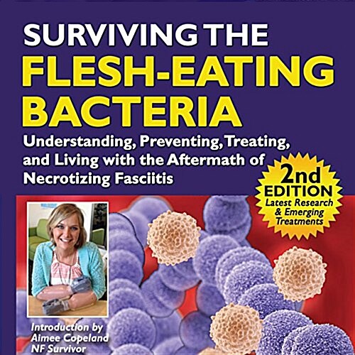 Surviving the Flesh-Eating Bacteria: Understanding, Preventing, Treating, and Living with the Aftermath of Necrotizing Fasciiti (Paperback)