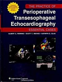 The Practice of Perioperative Transesophageal Echocardiography: Essential Cases (Hardcover)