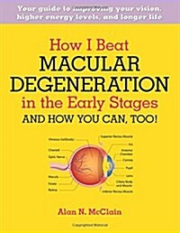 How I Beat Macular Degeneration in the Early Stages and How You Can, Too!: Your Guide to Improving Your Vision, Higher Energy Levels, and Longer Life (Paperback)