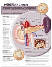 Understanding Pancreatic Cancer Anatomical Chart (Chart, 1st, Wall)