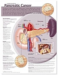 Understanding Pancreatic Cancer (Paperback, 1st, LAM, Wall)