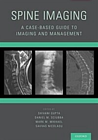 Spine Imaging: A Case-Based Guide to Imaging and Management (Paperback)