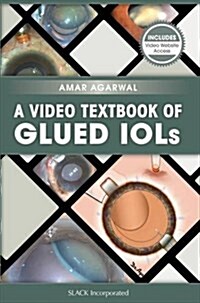 A Video Textbook of Glued Iols (Paperback)