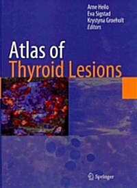 Atlas of Thyroid Lesions (Hardcover, 1st)