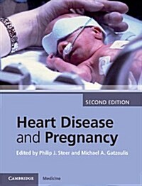 Heart Disease and Pregnancy (Hardcover, 2 Revised edition)