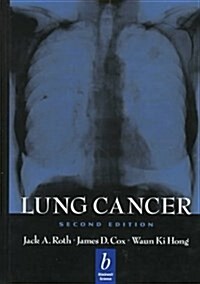 Lung Cancer (Hardcover, 2nd, Subsequent)