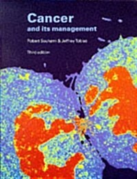 Cancer and Its Management (Paperback, 3rd, Subsequent)