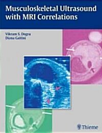 Musculoskeletal Ultrasound with MRI Correlations (Hardcover)