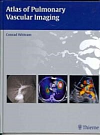 Atlas of Pulmonary Vascular Imaging (Hardcover)