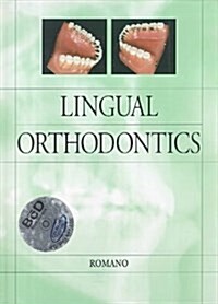 Lingual Orthodontics (Hardcover, CD-ROM)