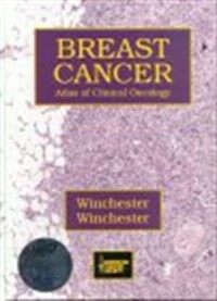 Breast cancer : atlas of clinical oncology