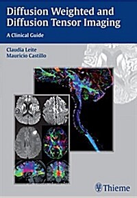 Diffusion Weighted and Diffusion Tensor Imaging: A Clinical Guide (Paperback)