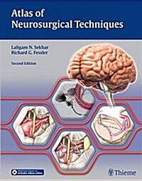 Atlas of Neurosurgical Techniques: Brain (Hardcover, 2)