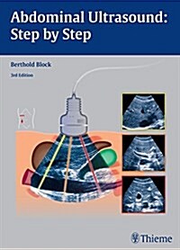 Abdominal Ultrasound: Step by Step (Paperback, 3)