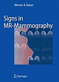 Signs in MR-Mammography (Paperback, Reprint)