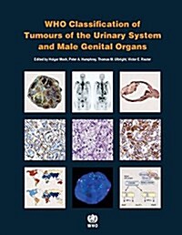 [중고] Who Classification of Tumours of the Urinary System and Male Genital Organs [Op] (Paperback, 4)