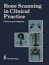 Bone Scanning in Clinical Practice (Paperback, Softcover reprint of the original 1st ed. 1987)