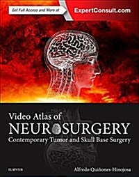 Video Atlas of Neurosurgery: Contemporary Tumor and Skull Base Surgery (Hardcover)