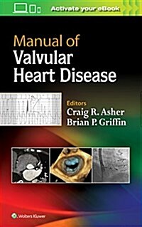 Manual of Valvular Heart Disease (Paperback)