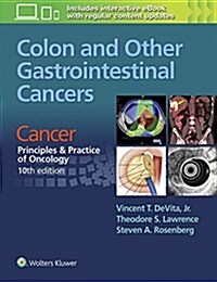 Colon and Other Gastrointestinal Cancers: Cancer: Principles & Practice of Oncology, 10th edition (Paperback, 10)
