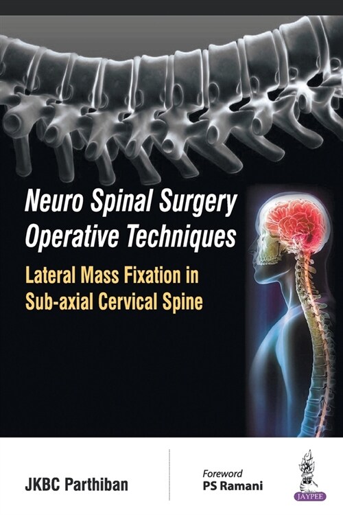Neuro Spinal Surgery Operative Techniques Lateral Mass Fixation in Sub-axial Cervical Spine (Paperback)